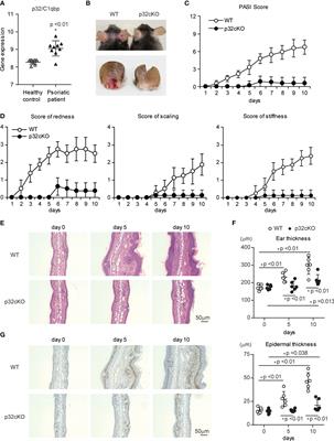 Mitochondrial Reactive Oxygen Species Are Essential for the Development of Psoriatic Inflammation